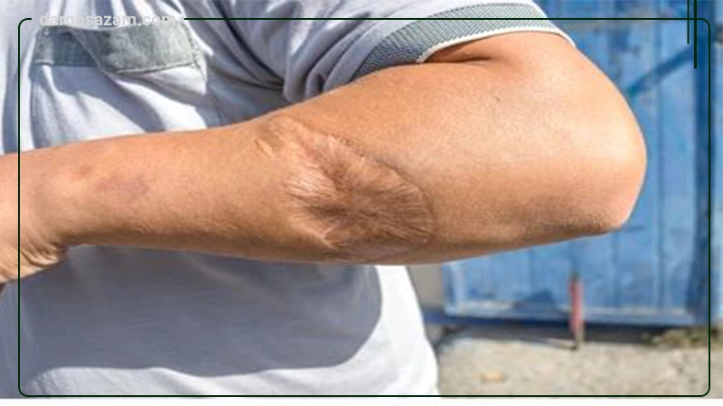 کرم ترمیم کننده پوست سینره 40 میلی لیتر