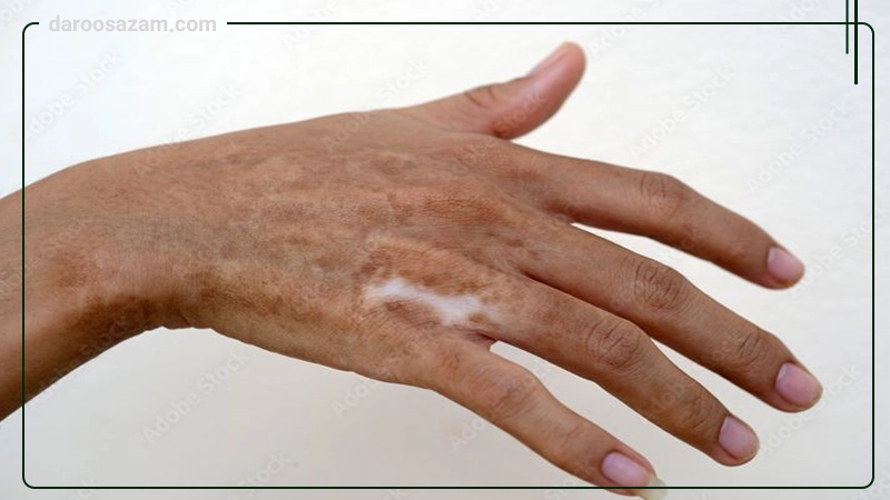 کرم کلاسنت ایده دارو طب 30 گرم