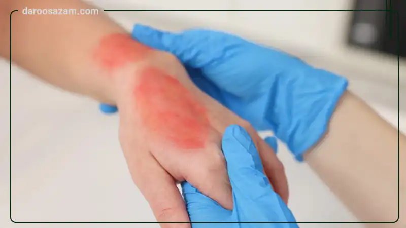 پماد ریکاو توسن دارو 25 گرم