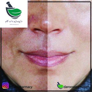 کرم روشن کننده داروسازم دات کام