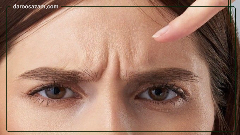 کرم ضد چروک و ترمیم کننده سطحی اسکن اسکین 30 میلی لیتر