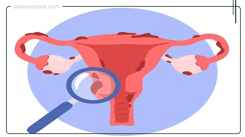 کپسول لاکتوفم زیست تخمیر 30 عددی (یخچالی)