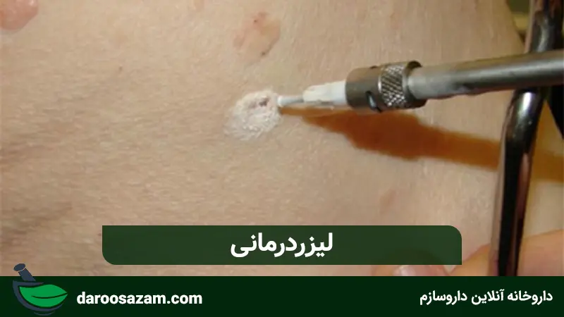 کرم زگیل تناسلی