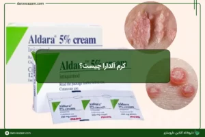 آلدارا چیست