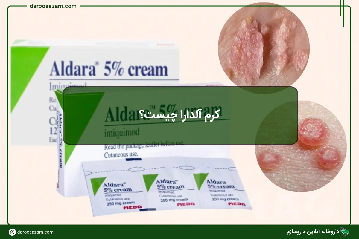 آلدارا چیست