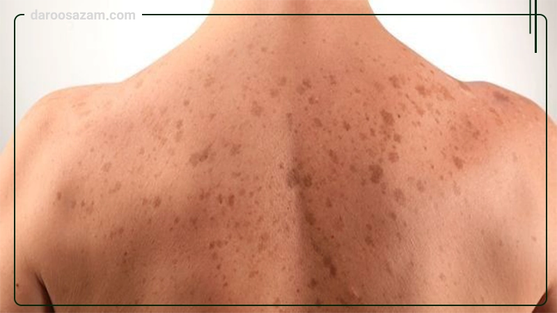 کرم ترمیم کننده پوست ژنوبایوتیک 30 میلی لیتر