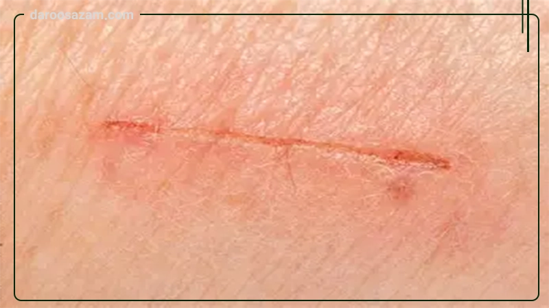 ژل استراتامد استرات فارما 10 گرمی