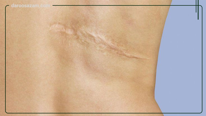 ژل ترمیم کننده کنتراکتیوبکس مرز 20 گرمی