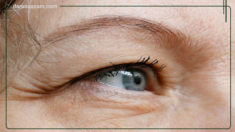 کرم ترمیم کننده دور چشم سیکاسول آیسول 10 میلی لیتر
