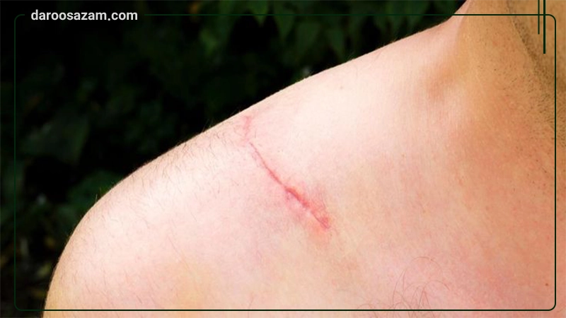 کرم ترمیمکننده اوی سنسیتیو اویدرم 30 میلیلیتر