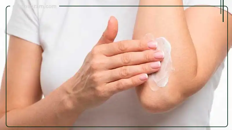 کرم هان اسکین سپیداج 30 گرم