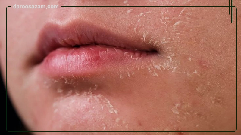 کرم امولیانت اینتنس اسکین وان