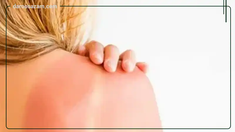 سرم ضد آفتاب صورت و گردن SPF30 ژنوبایوتیک 30 میلی لیتر