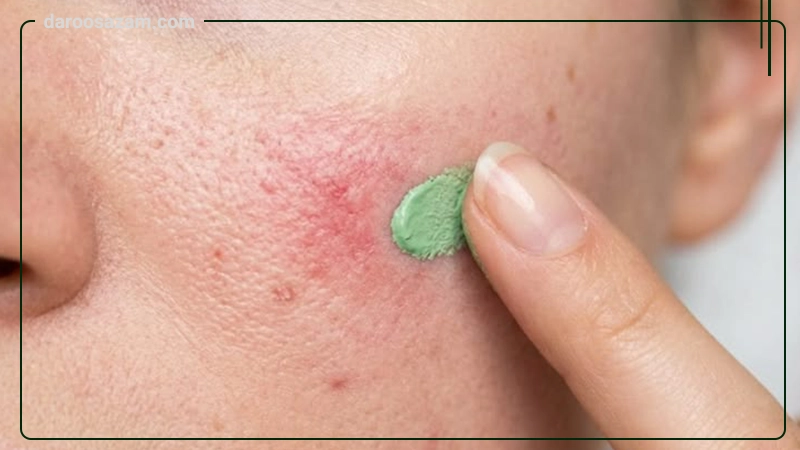 کرم یکنواخت کننده رنگی پوست چرب و جوشدار سبوما آردن