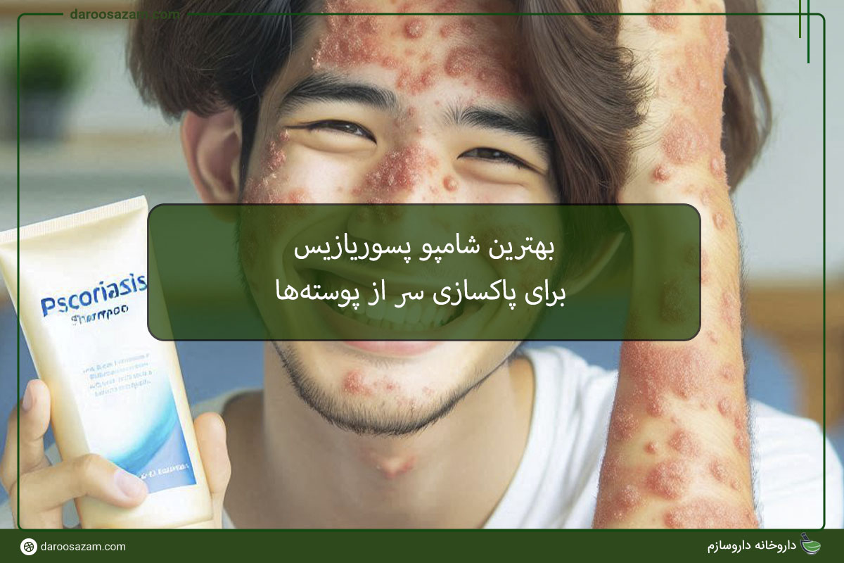 بهترین شامپو پسوریازیس