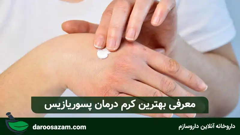 معرفی بهترین کرم درمان پسوریازیس