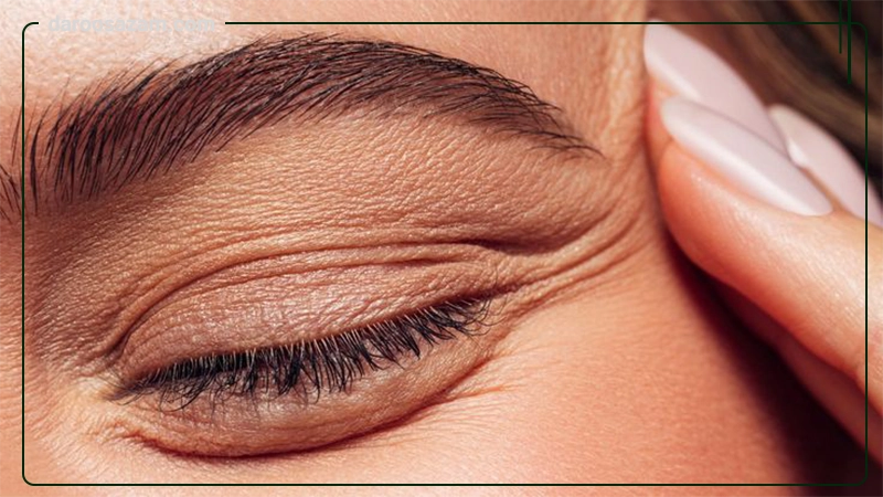 کرم ترمیم کننده