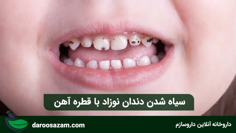 سیاه شدن دندان‌ نوزاد با قطره آهن