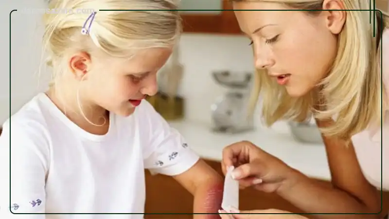 کرم سوختگی پا کودک مامابیبی 100 میلی لیتر