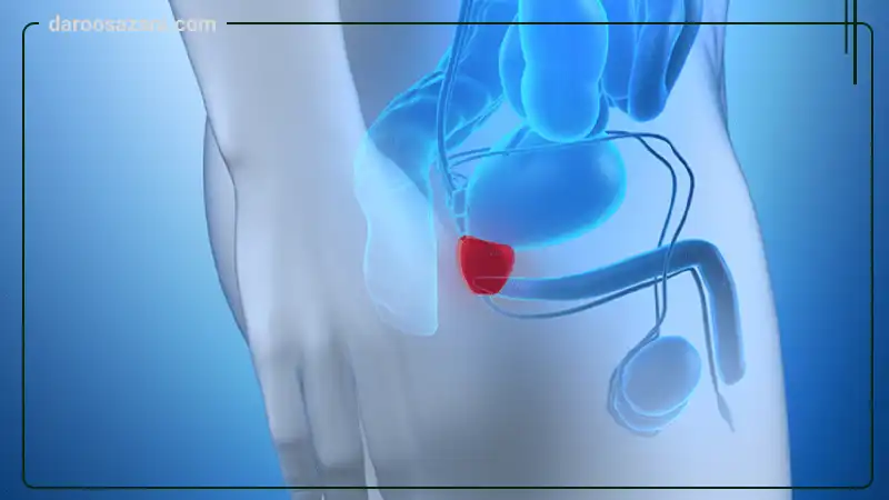 قرص پروستات