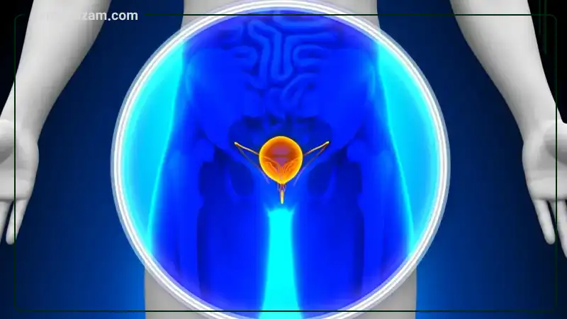 قرص پروستات