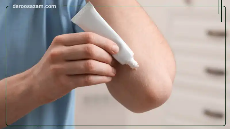 پماد سوختگی