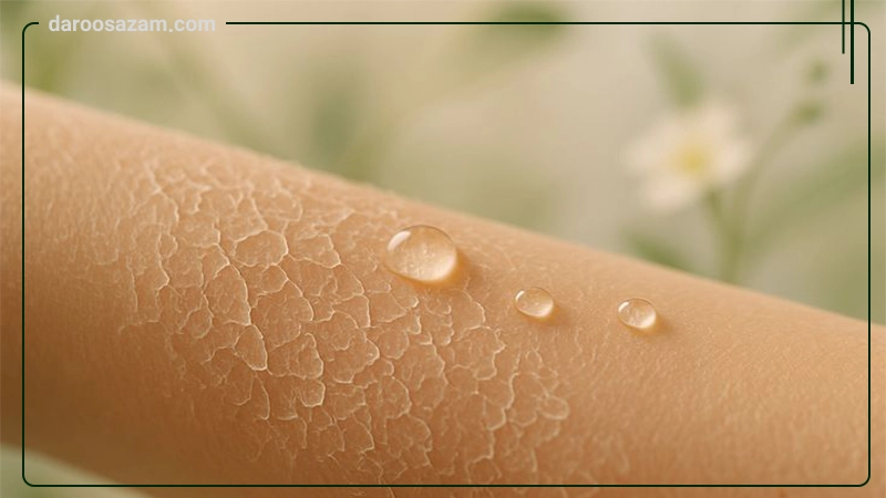 التیام بخش پوست