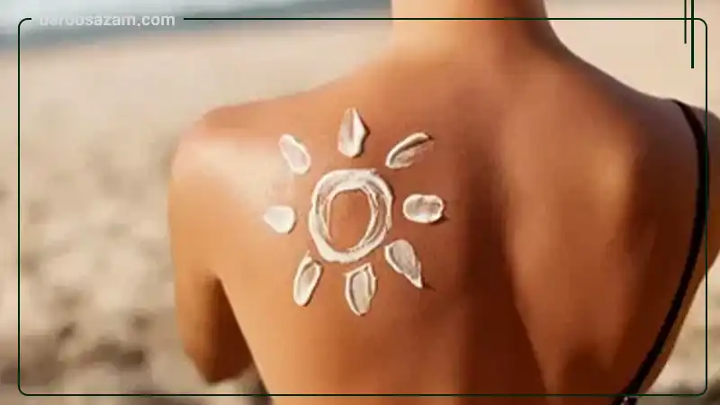 آفتاب سوختگی