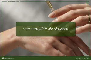 بهترین روغن برای خشکی پوست دست
